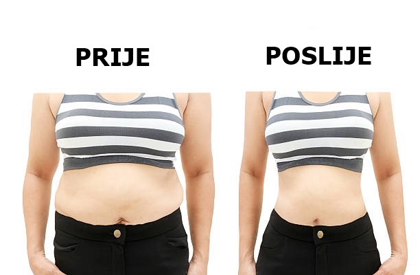 Prije i poslije